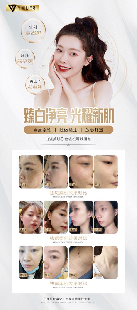 合作已秀减肥合作贵不贵